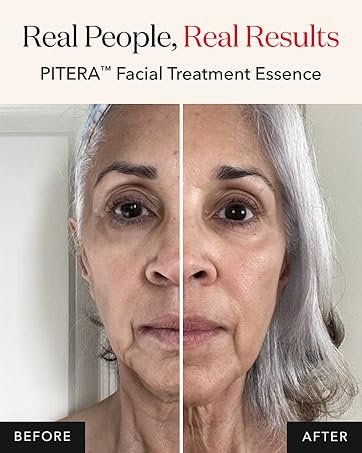 Real People Real Results PITERA facial treatment essence before and after image